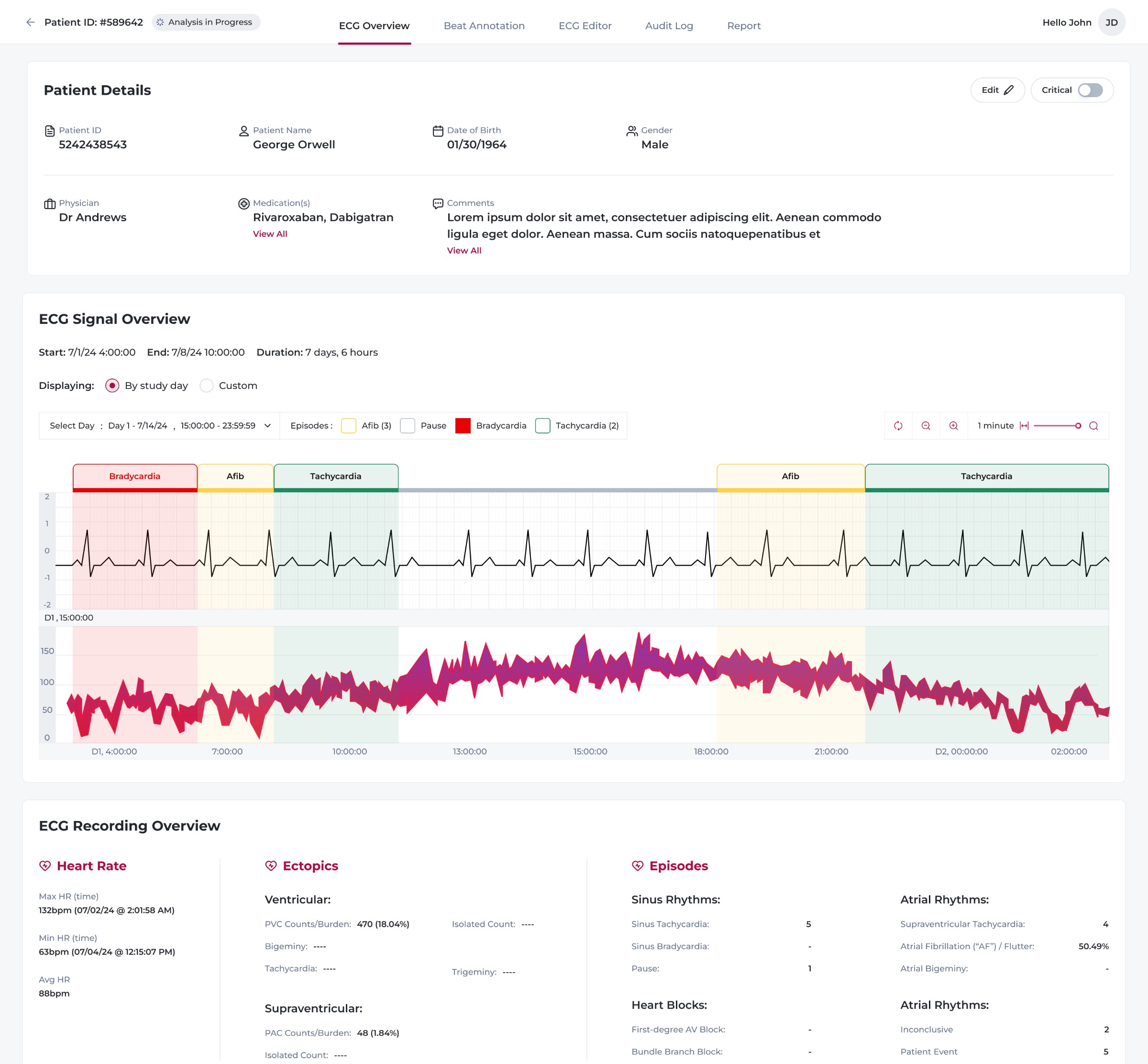  ECG Overview Experience Design Image 3