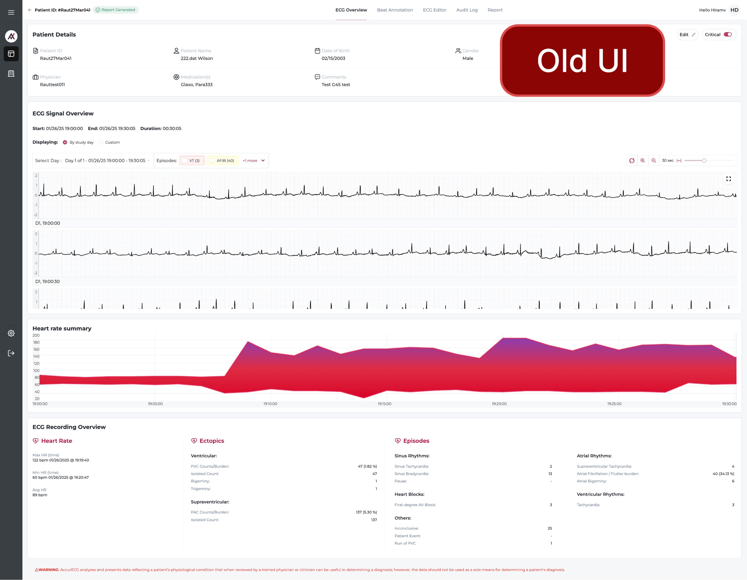  ECG Overview Experience Design Image 4