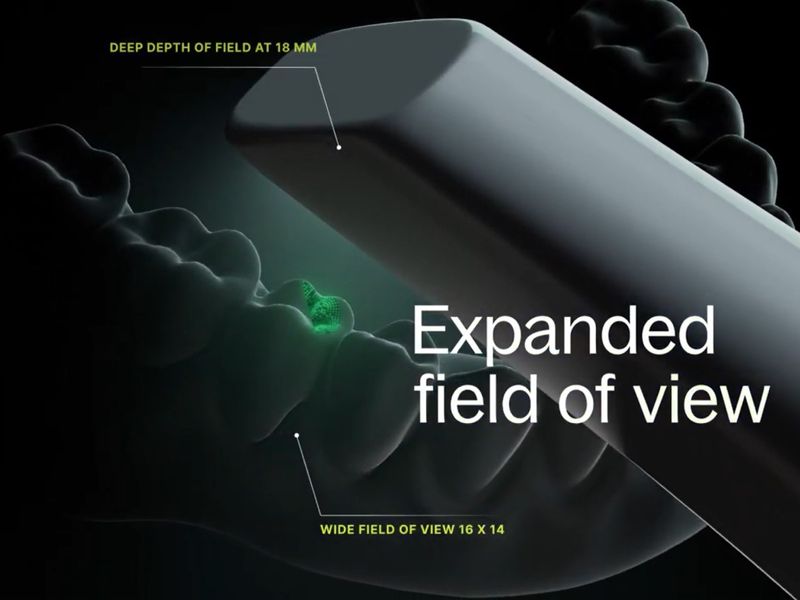 Dandy Vision Intraoral Scanner - Dandy