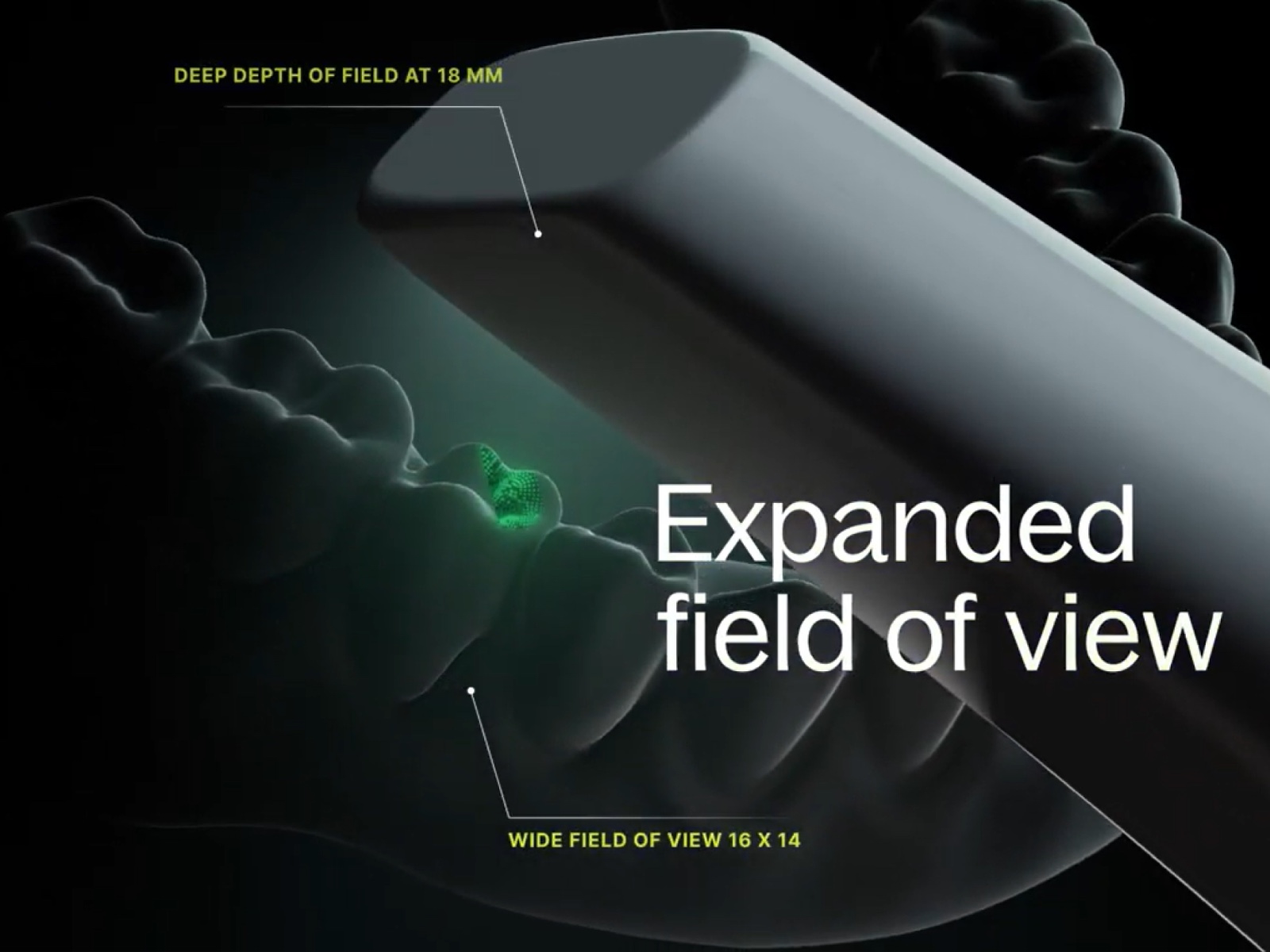 Dandy Vision Intraoral Scanner - Dandy